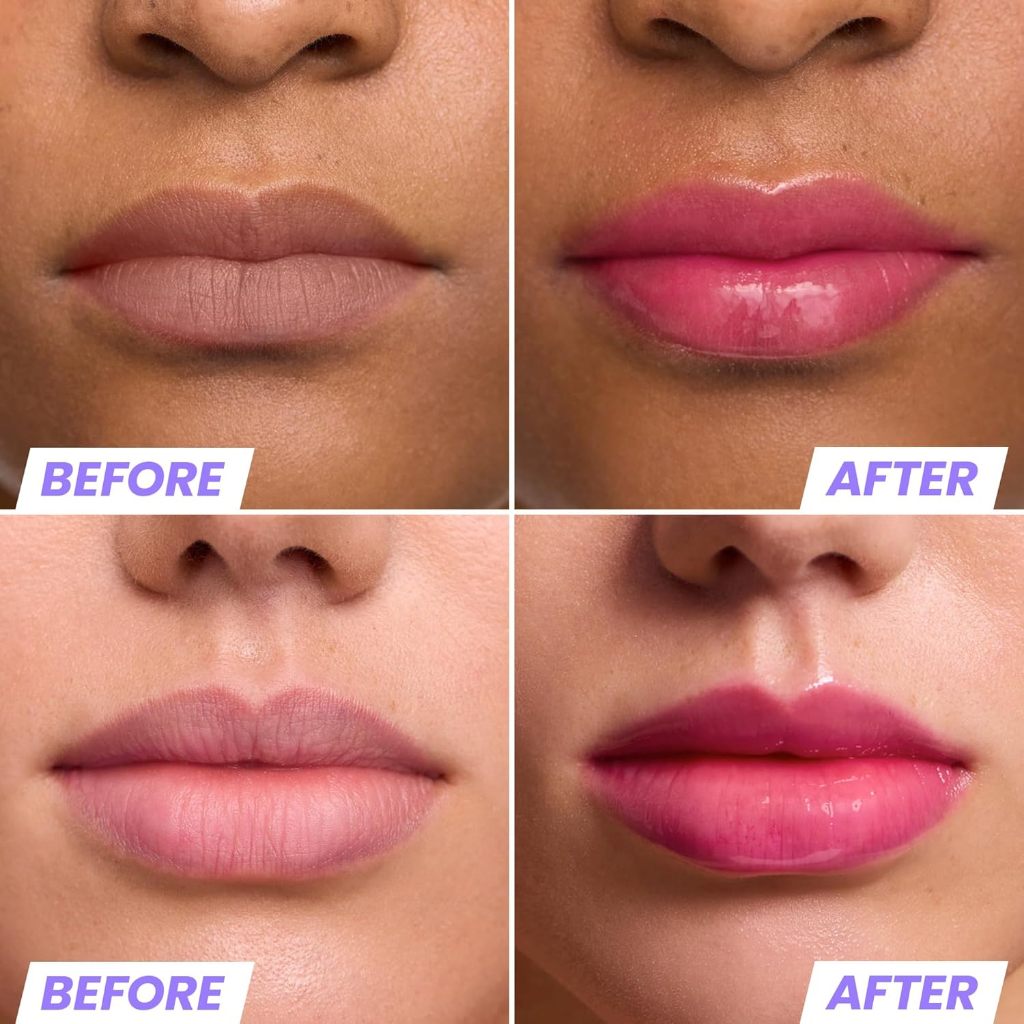 Wonderskin Lip Rehab Serum Oil 3.57ml KISSED