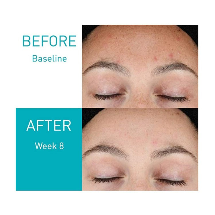 Cerave Resurfacing Retinol Serum 30ml