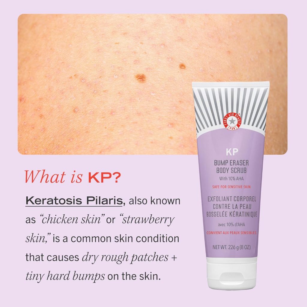 First Aid Beauty KP Bump Eraser Body Scrub 226g | Exfoliates Roughness + Scaly Areas