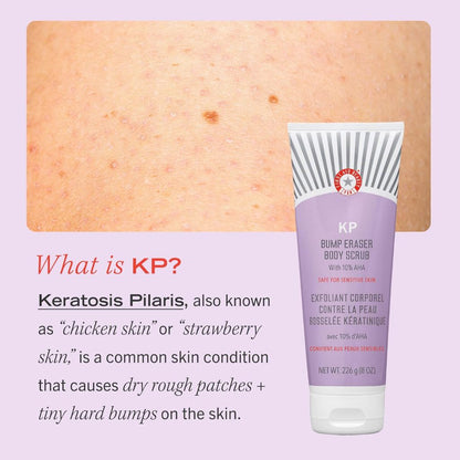 First Aid Beauty KP Bump Eraser Body Scrub 226g | Exfoliates Roughness + Scaly Areas