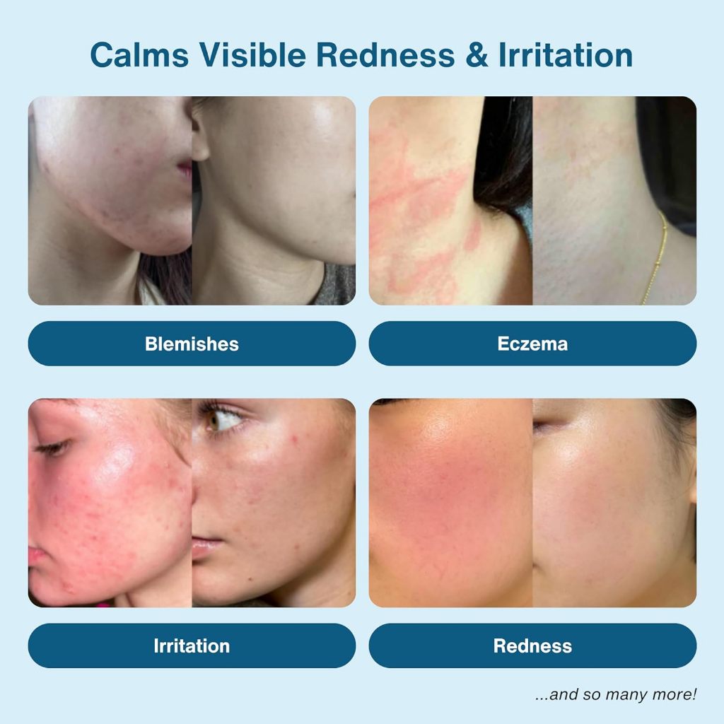 Honeydew Labs Hypochlorous Acid Face Spray 200ml EXP 05.26