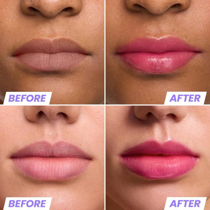 Wonderskin Lip Rehab Serum Oil 3.57ml KISSED